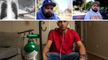 Silent Health Crisis: Silicosis Strikes California Countertop Workers